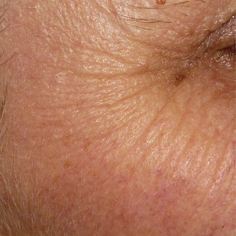 Before image